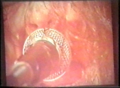 Screenshot Preview